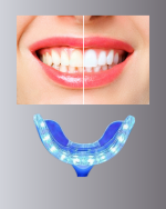 LED Işıklı Profesyonel Diş Beyazlatma Seti